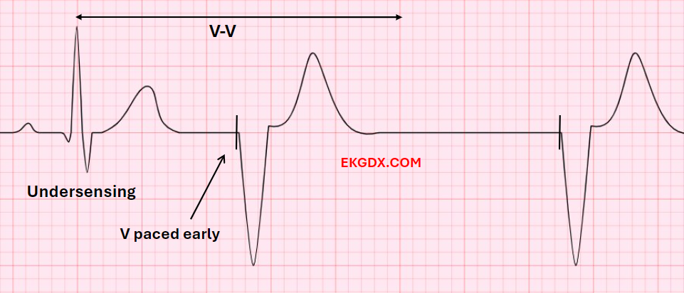 EKGDX - The new era of EKG learning
